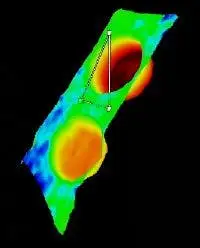 IPLEX NX Videoscope — view 6