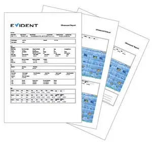 Easy Reporting Tools